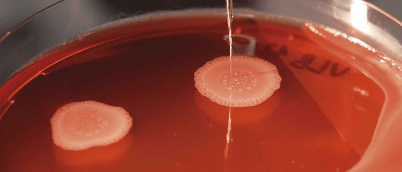 Biofilm – Oxygen and redox potential in P. aeruginosa